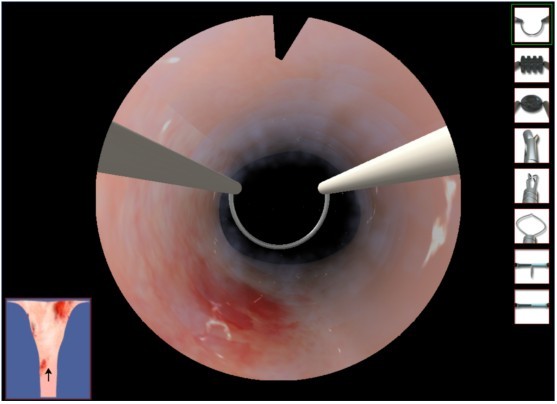 宮腔鏡手術模擬器