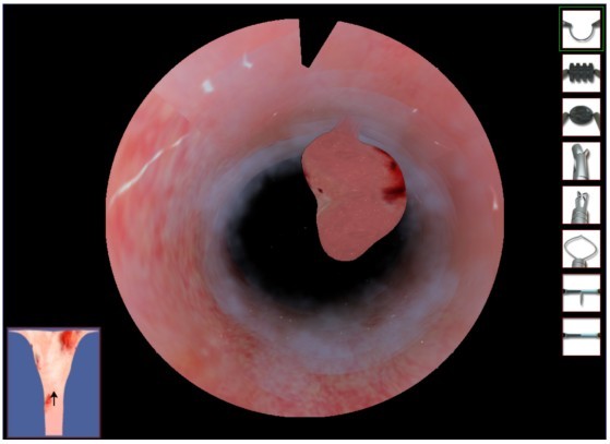 宮腔鏡手術模擬器